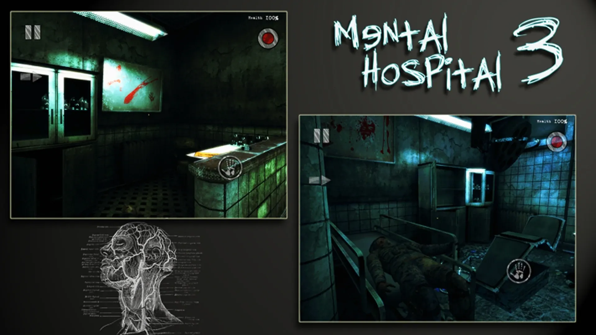Mental Hospital III Remastered v2.01 APK Мод (Полная версия) Screenshot 1 Mental Hospital III Remastered v2.01 APK Мод (Полная версия) Screenshot 1